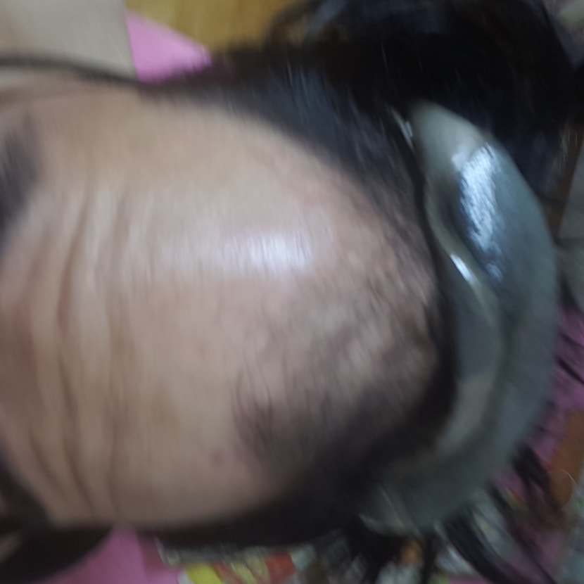 머리상태 및 가발 재낌
