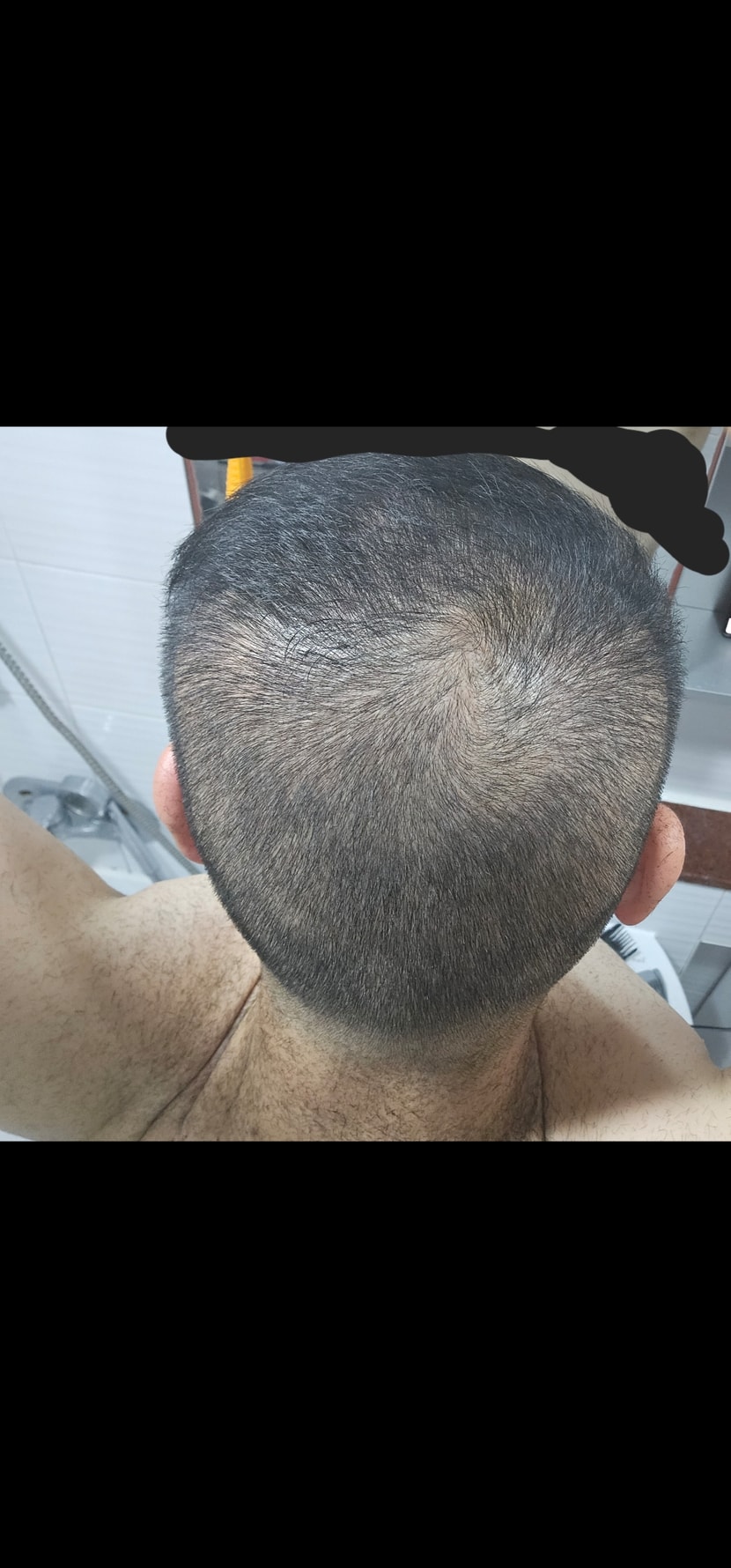 현재