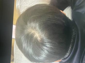 정수리