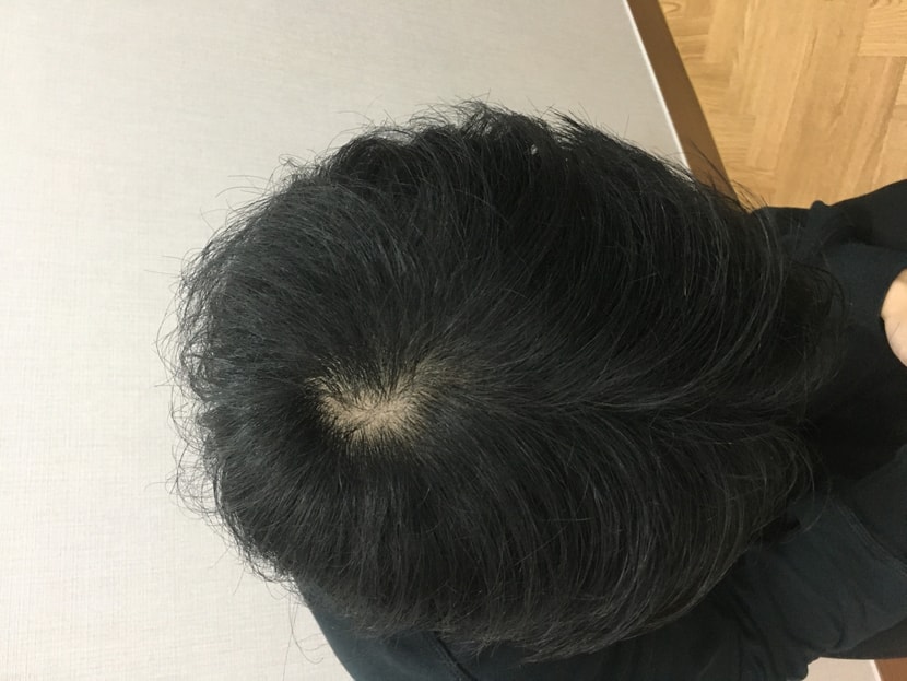 의사쌤이찍은머리