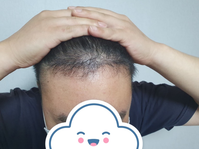 6개월후