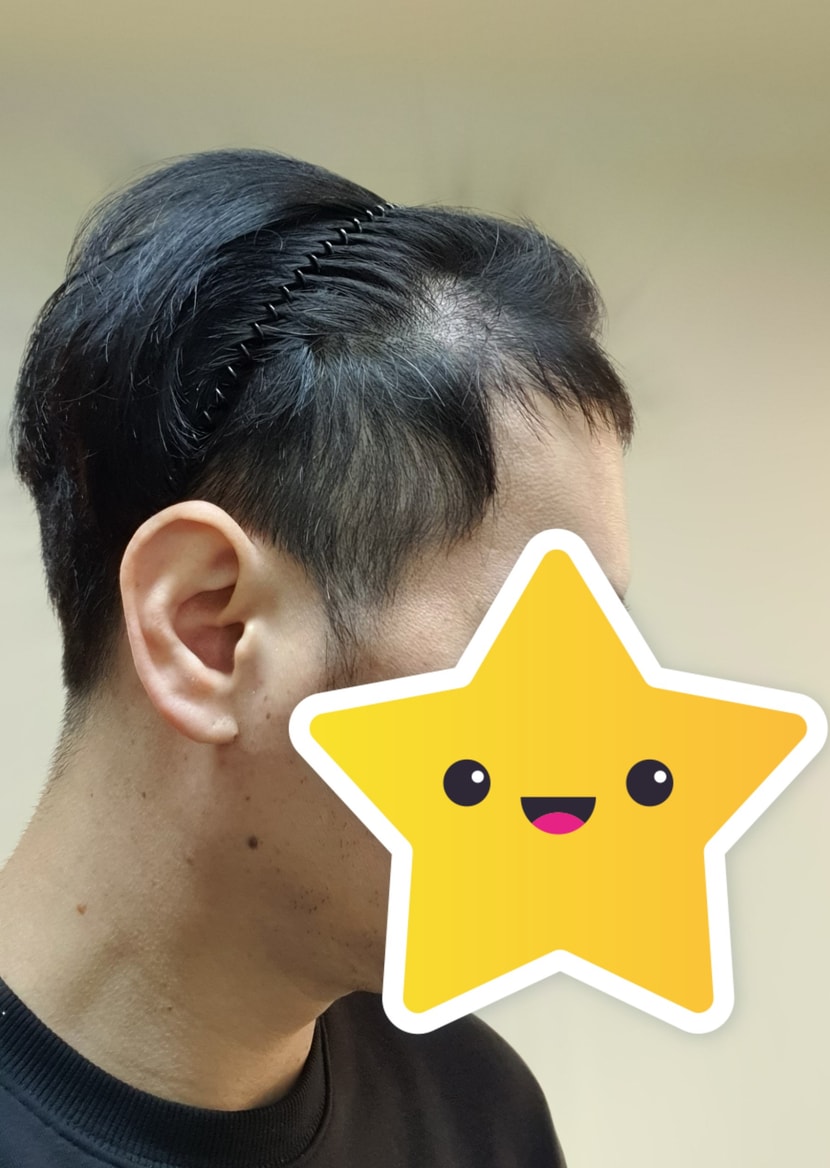 3개월차