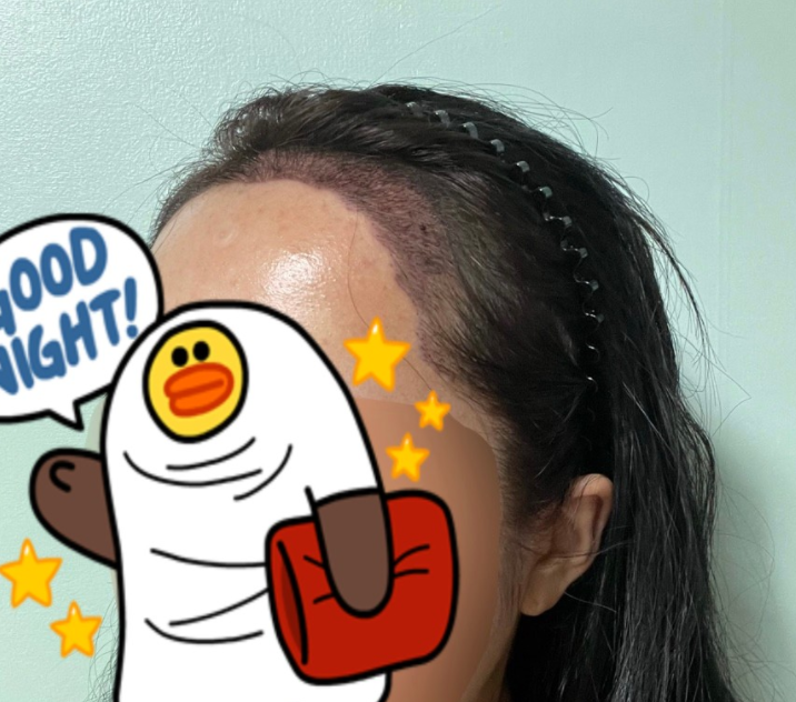 후