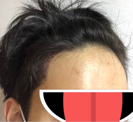 1일차 두번째 사진
