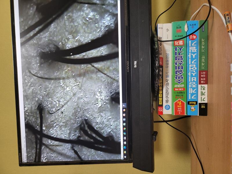 로게인폼 48일차 후기(feat. PRP,메조)- 2번째