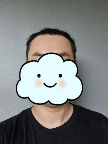 수술전 입니다