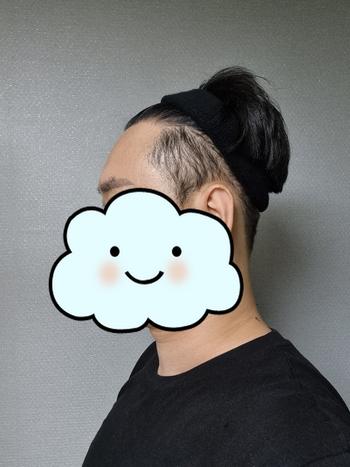 수술전 입니다