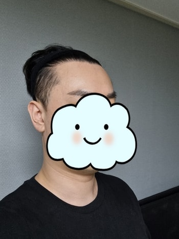 수술전 입니다