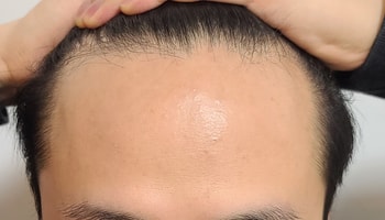 수술 전 입니다 (3장)