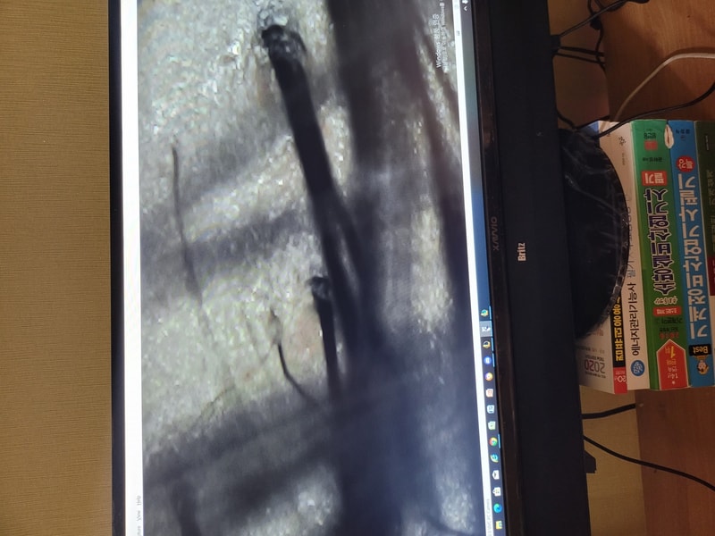 로게인폼 37일차 후기