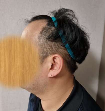 &lt;전&gt;