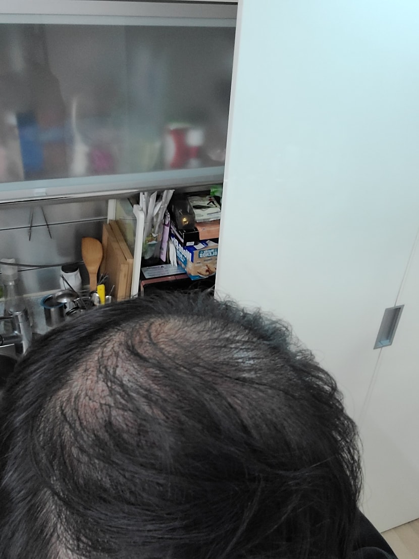 후