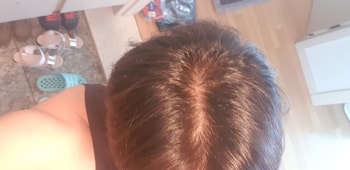 3개월차