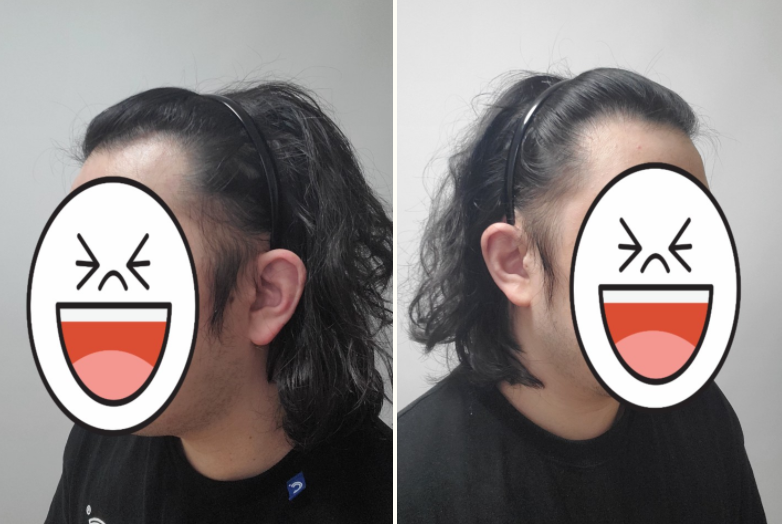 수술 하기 전이에요