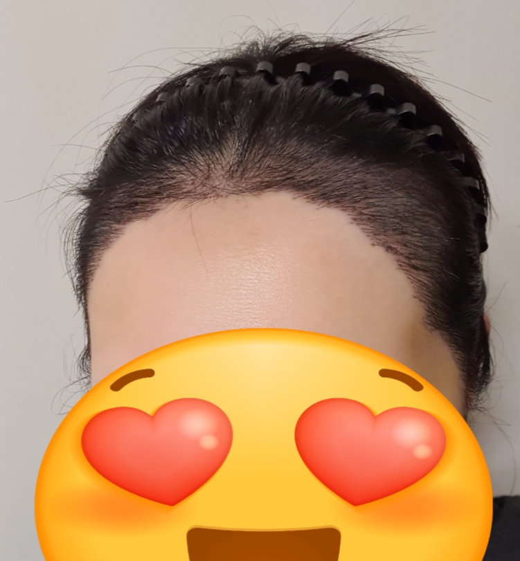 현재 3장