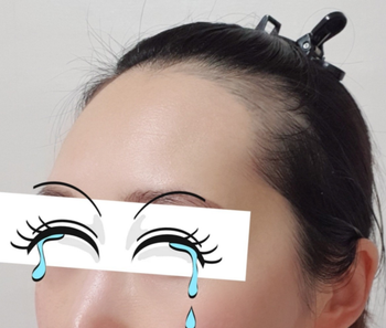 수술 전 3장