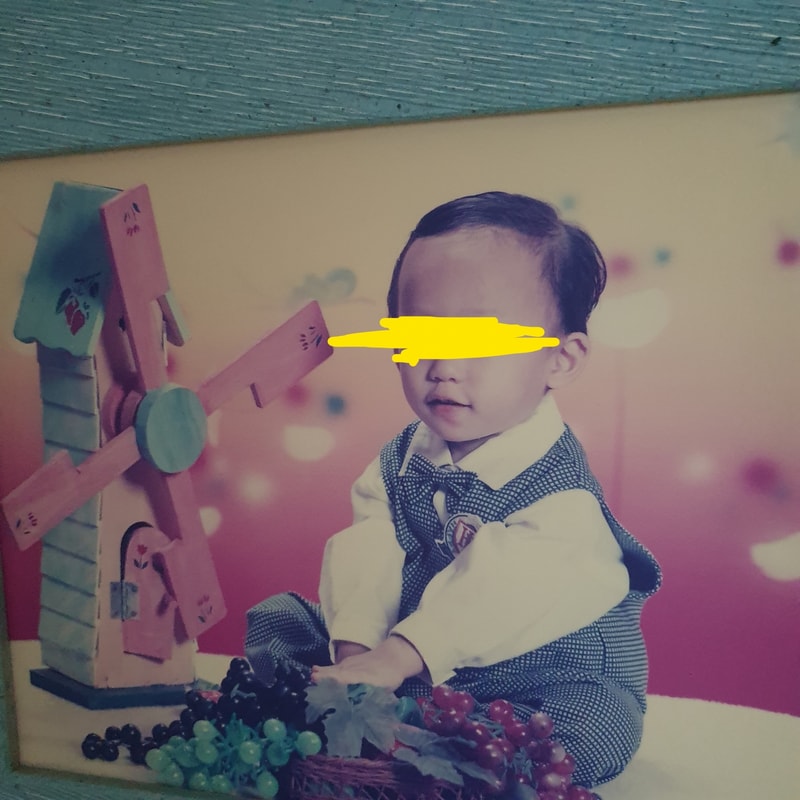 진짜 탈모 감별 고수 분만!! 사진 있음 절박하다 진짜