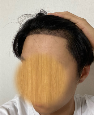 현재