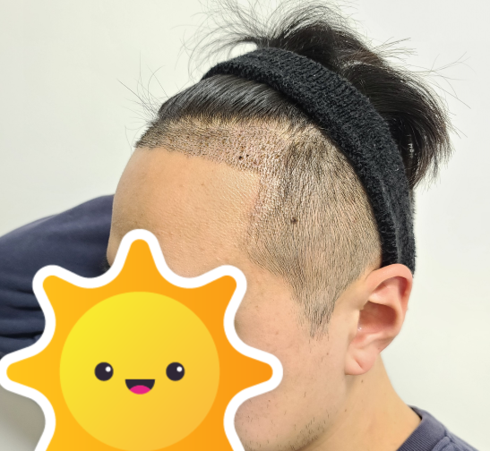 수술 후