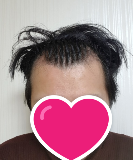수술 후