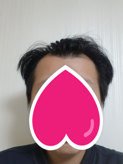 수술 전 이에요