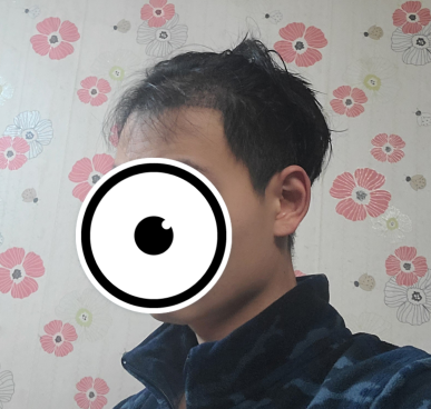 후