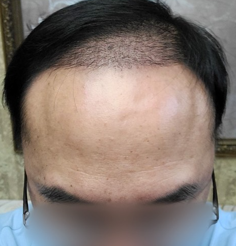 현재