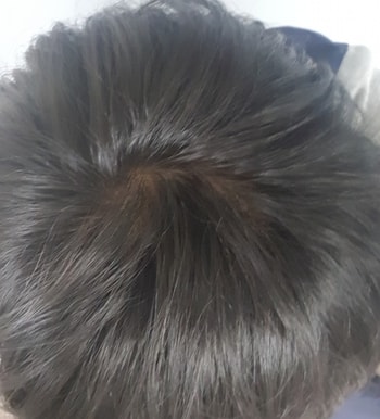 어두운곳 추가