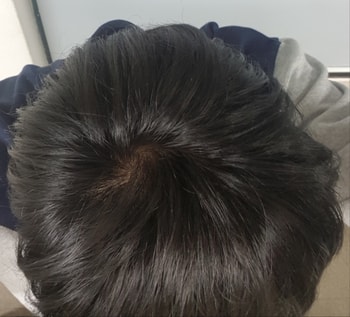 어두운곳
