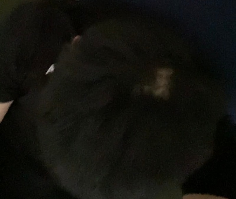 정수리 탈모인가요..?