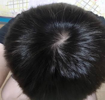 정수리1