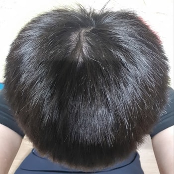 윗머리