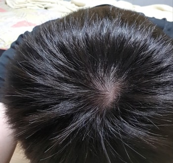 정수리 고개 숙이고 찍은것