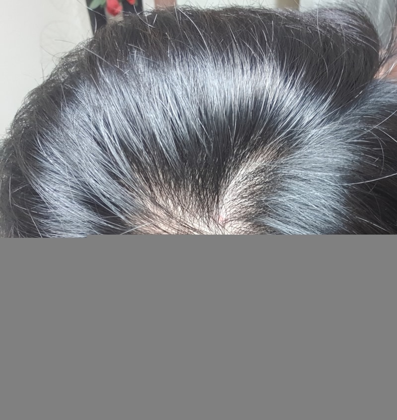 25岁中期，普罗佩西亚8个月后期