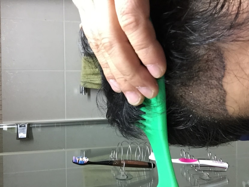 앞머리
