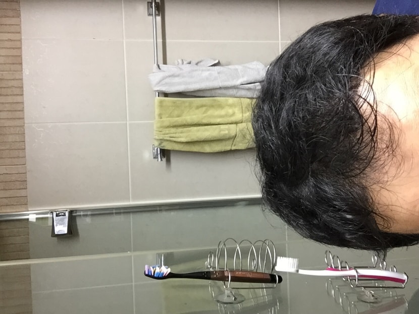 기존머리로 커버