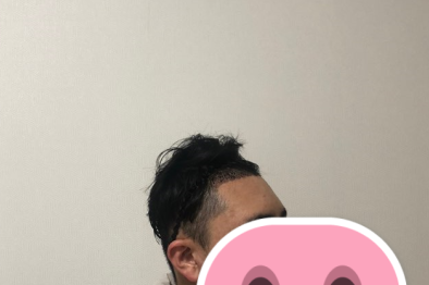 후