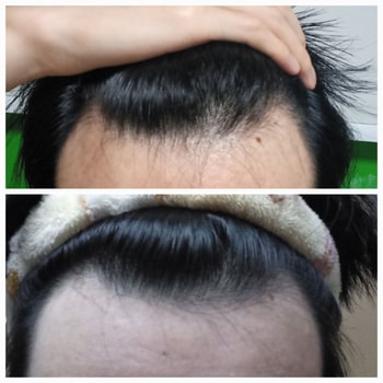 위 현재 / 아래 2021년
