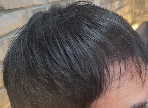 후