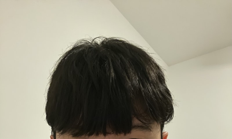 髪の毛が少し薄く見えますが···?