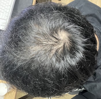 정수리