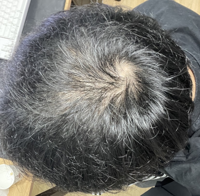 정수리