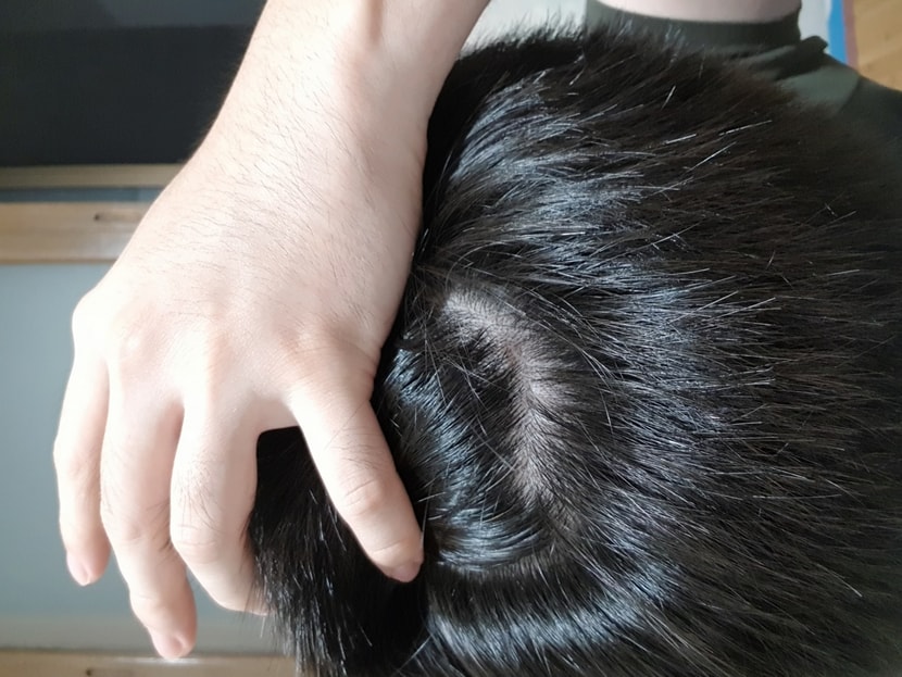 23년 8월 7일 속알머리