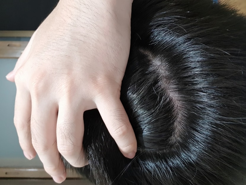 23년 8월 7일 속알머리