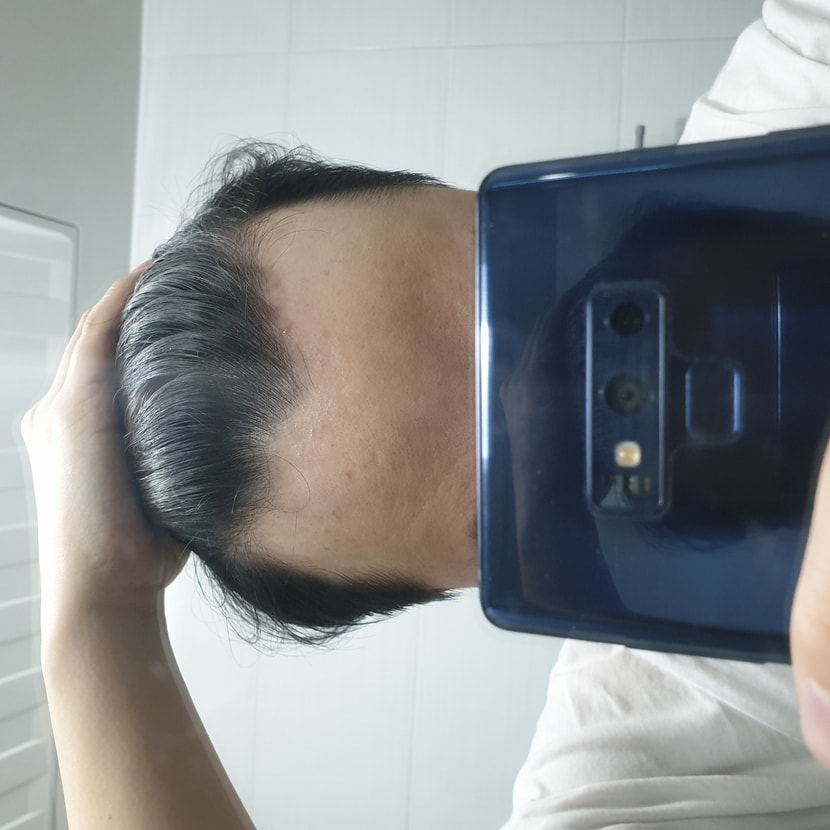 정면