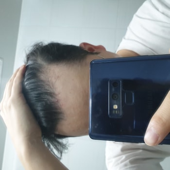 우측