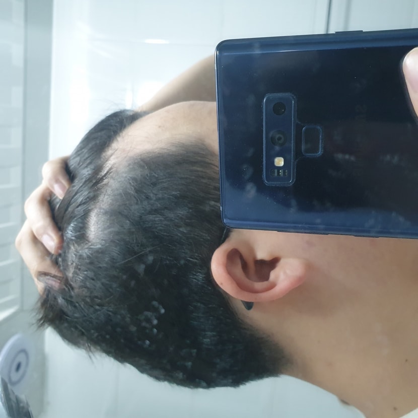 좌측