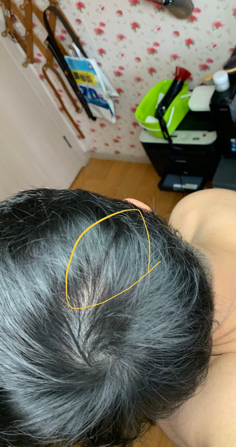 이부분이 왜빠지는 건지 유독