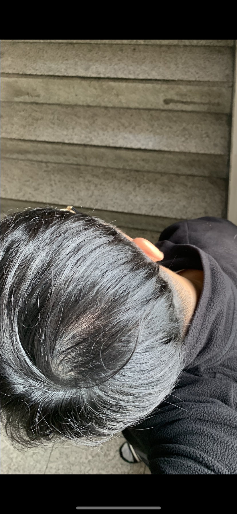 정수리 옆인데.. 여기가 왜이러지 요즘..