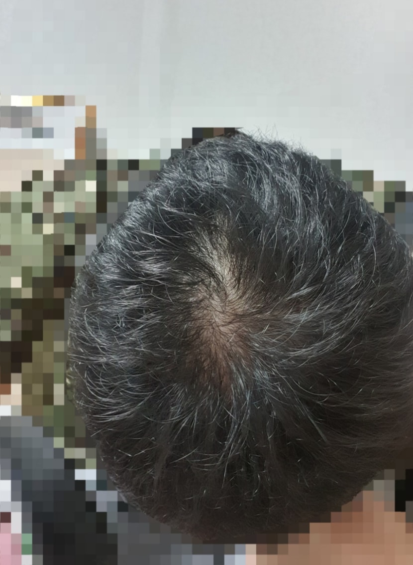 빗질도 안 한 현재 사진입니다.